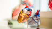 A fruta adocicada é benéfica à saúde do coração, ajudando os vasos sanguíneos. - Foto: Unsplash