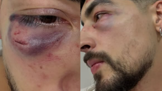 Reprodução/ Instagram