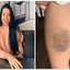 Nutricionista usou artes marciais para se defender de estupro em SP\u003B entenda o caso