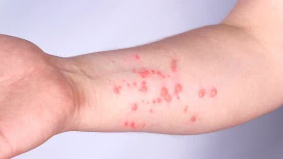 Foto: Reprodução/Divulgação