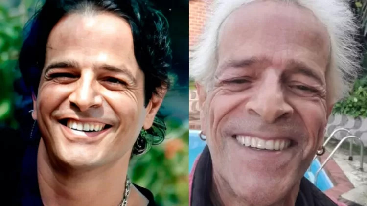 Felipe Martins antes e depois. 