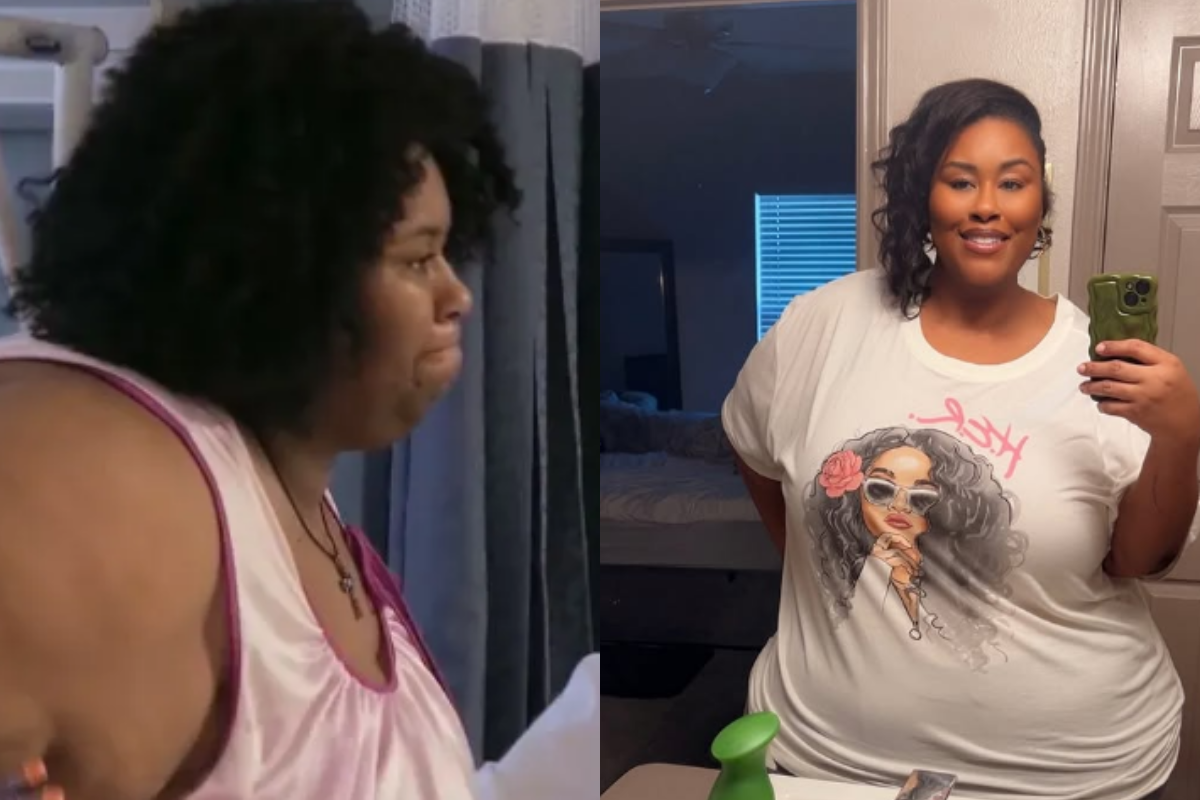 Octavia antes e depois. 