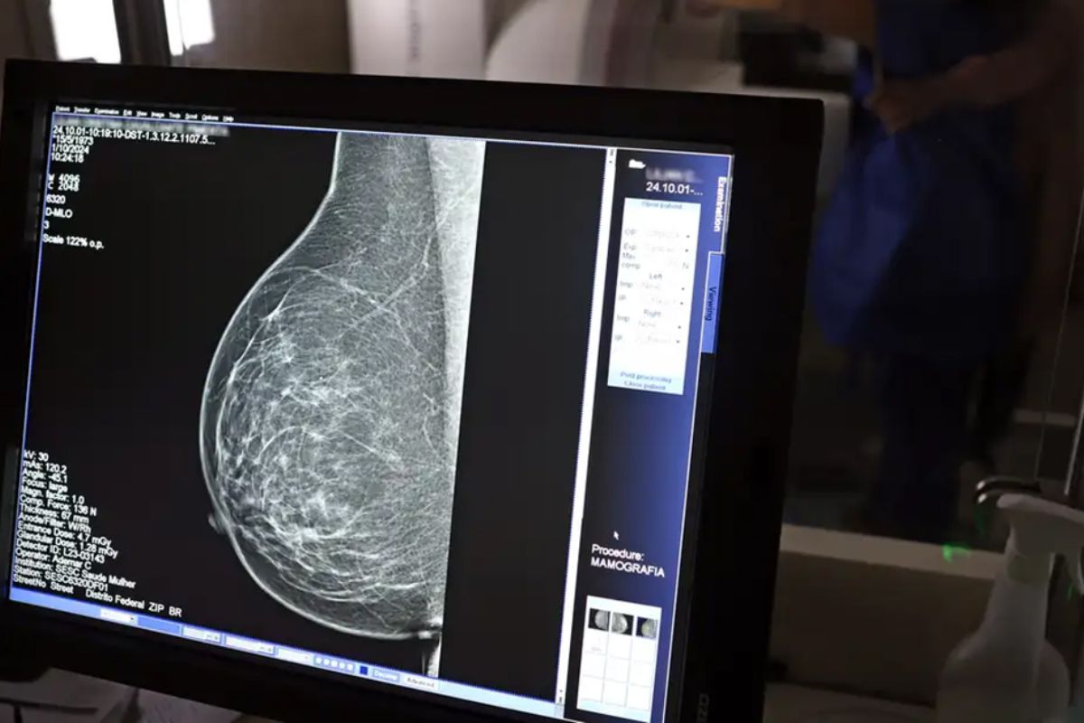 As imagens ficam prontas logo após a realização do exame