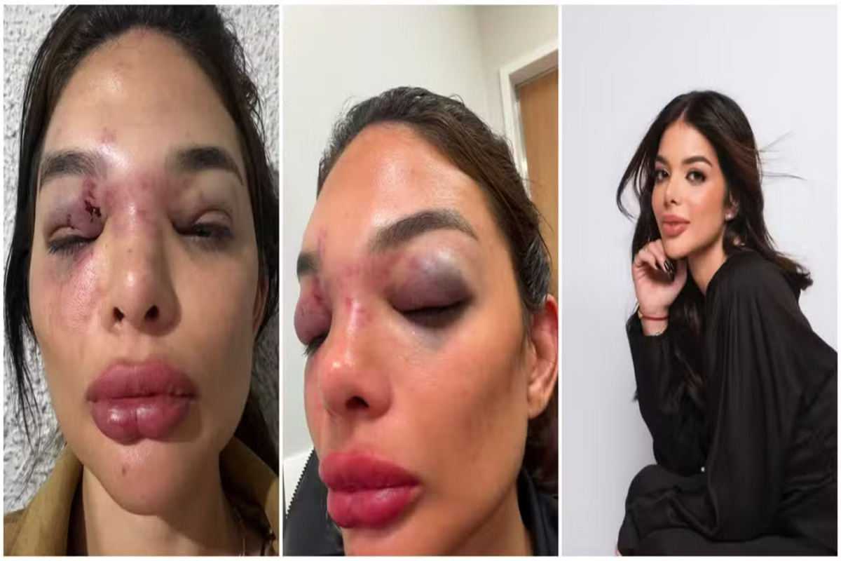 Esposa denunciou as agressões nas redes sociais
