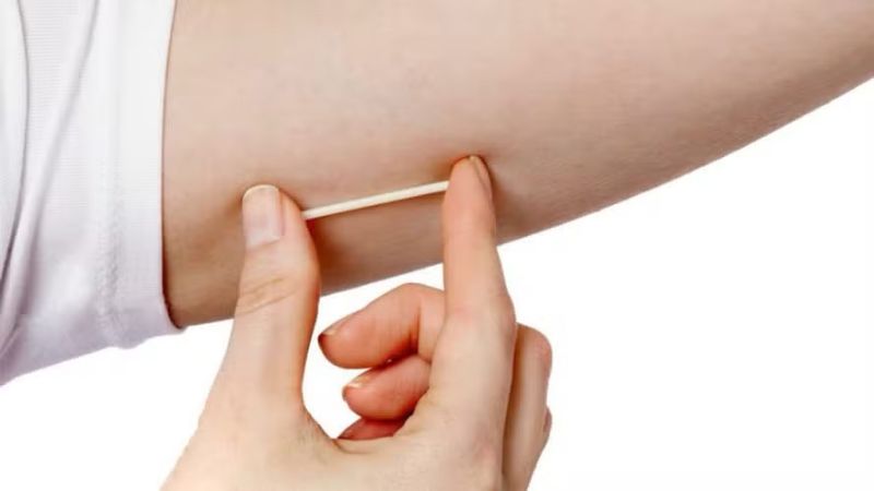 Uso do "chip da beleza" pode trazer riscos à saúde (Foto: Reprodução)